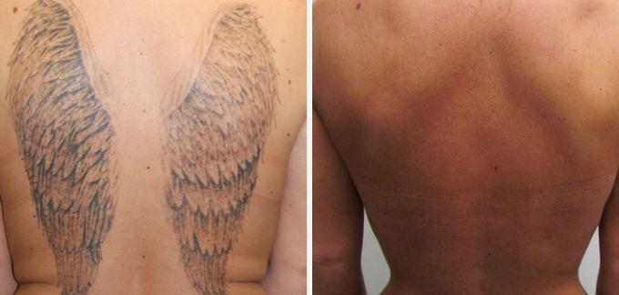 tat1